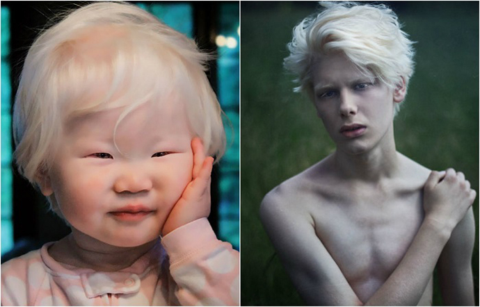 beautiful-albino-people-0