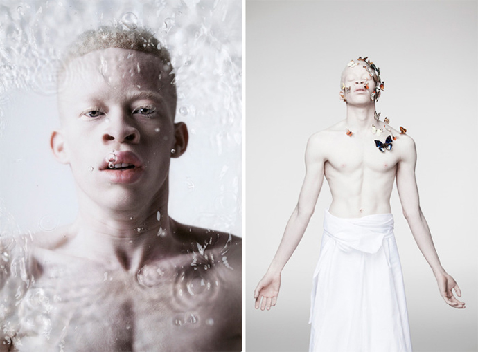 beautiful-albino-people-12