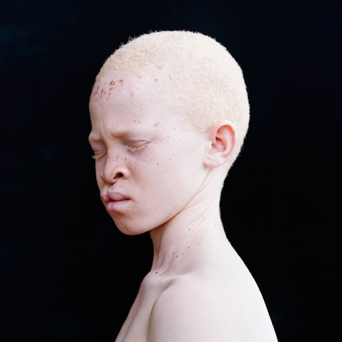 beautiful-albino-people-14