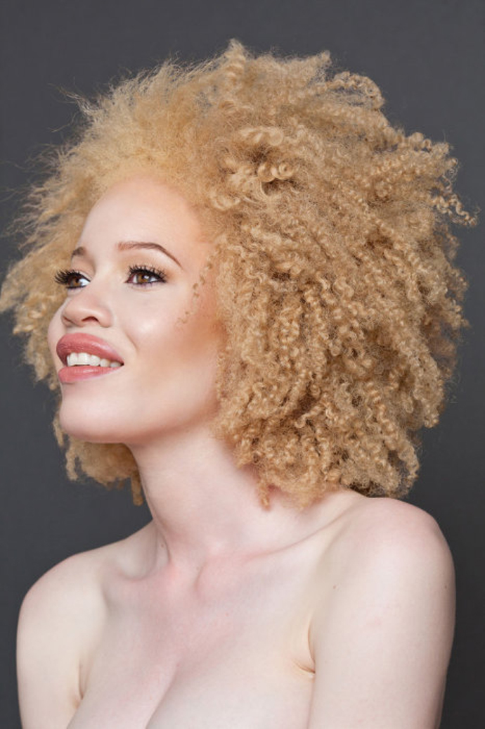 beautiful-albino-people-8